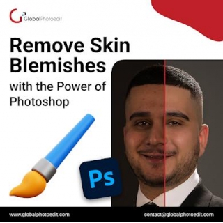 Remove Skin Blemishes With The Power Of Photoshop