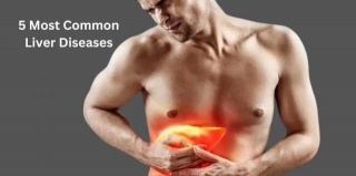 LIVER PROBLEM AND CURE