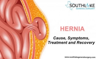 Hernia: Causes, Symptoms, And Treatment