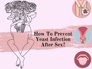 PREVENT YEAST INFECTION AFTER SEX