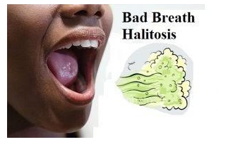 CURE MOUTH ODOUR PERMANENTLY
