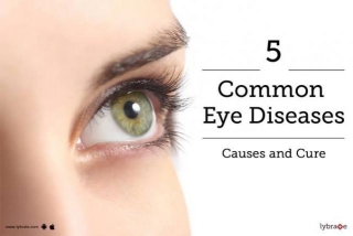Top Causes Of Eye Problems