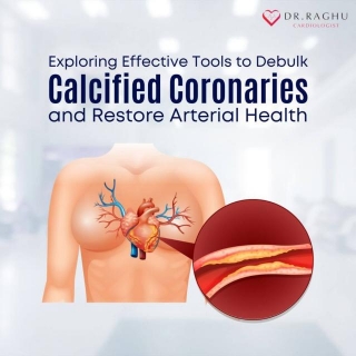 Exploring Effective Tools To Debulk Calcified Coronaries And Restore Arterial Health