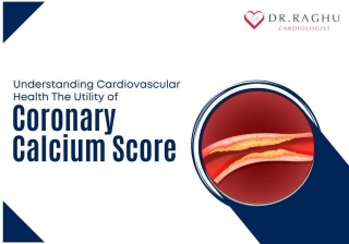 Understanding Cardiovascular Health: The Utility Of Coronary Calcium Score
