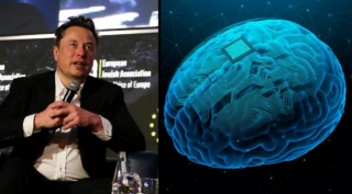 The Race Of Brain Implant Devices: Elon Musk's Neuralink Vs. Jeff Bezos And Bill Gates' Synchron Inc