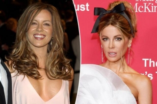 Kate Beckinsale Shuts Down Plastic Surgery Rumors Following Her Monthslong Hospital Stay  Page Six