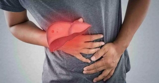 Daily Aspirin Can Significantly Reduce Liver Fat Content In Metabolic Dysfunction-associated Steatotic Liver Disease: Study