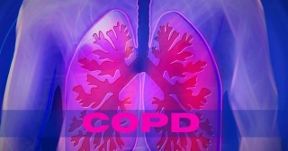 Bisoprolol Safe And Effective For Treating Chronic Obstructive Pulmonary Disease: Study