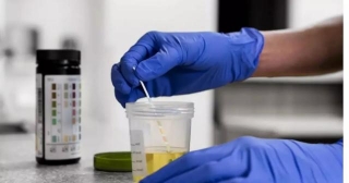RaDPi-U, Promising Fast And Convenient Technique For Screening Drugs In Urine Samples, Reveals Study