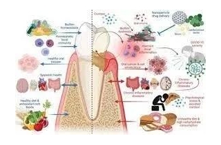 Consumption Of Dietary Live Microbes Directly Associated With Improved Periodontal Health Suggests Study