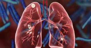 New Ultrasound Technology May Revolutionize Respiratory Disease Diagnoses