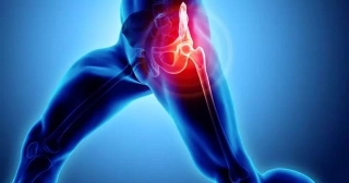 Progressive Resistance Training As Good As Neuromuscular Exercise For Relieving Pain In Hip OA Patients: Study
