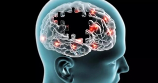 Increased RDW May Be Considered As A Biomarker Of Mild Cognitive Impairment : Study