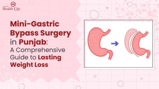 Mini-Gastric Bypass Surgery In Punjab: A Comprehensive Guide To Lasting Weight Loss