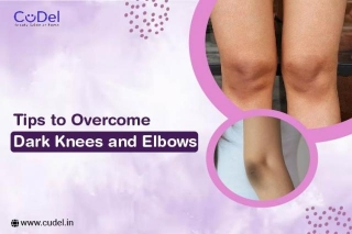 Tips To Overcome Dark Knees And Elbows