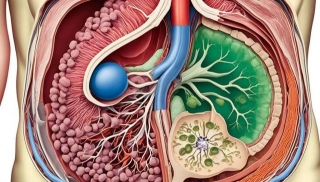 Recognizing Bile Duct Disorder Symptoms