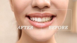 Maintaining Oral Health With Orthodontic Treatment In Las Vegas