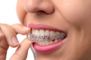 Invisalign Cost Las Vegas With Boca Dental And Braces