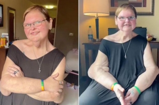 1000-lb Sisters Star Tammy Slaton Shows Off Excess Skin In Full Body Photos After Weight Loss