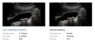 Accelerate Ultrasound Imaging Annotation With Labellerr