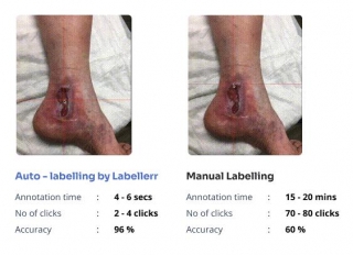 Enhancing Wound Image Segmentation With Labellerr