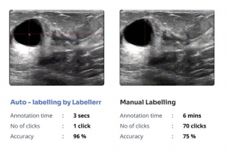 Accelerate Tumor & Lesion Annotation With Labellerr