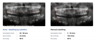 Automate Dental Image Annotation With Labellerr