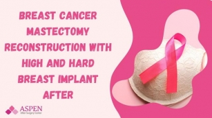 Breast Cancer Mastectomy Reconstruction With High And Hard Breast Implant After