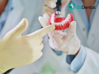 How Often Should You Get Your Dentures Relined?