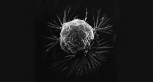 Breakthrough In Cancer Diagnosis: New Method Predicts Cell Behavior With High Accuracy