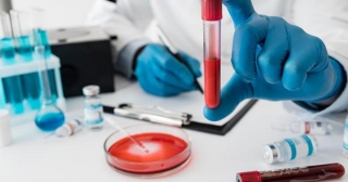 Sanjivini Diagnostics: Your Premier Choice For Blood Testing
