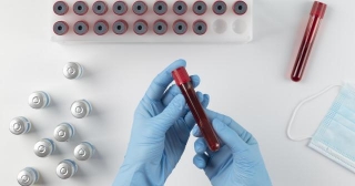 Embark On Your Health Journey: Explore Blood Testing Services At Sanjivini Diagnostics, Chandigarh