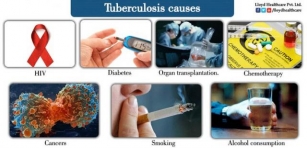 Understanding Tuberculosis: Symptoms, Causes, And Prevention