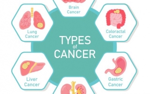 Understanding Cancer: Types, Causes, and Prevention
