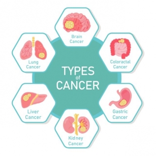 Understanding Cancer: Types, Causes, And Prevention