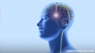 Deep Brain Stimulation Vs. TMS: Which Is Right For You?