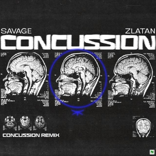 Music: Savage - Concussion Remix Ft Zlatan