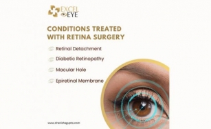 Retina Surgery In Delhi: An Overview