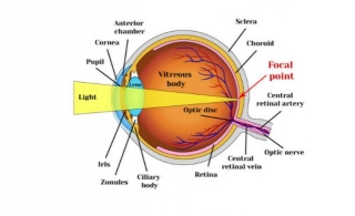 Refractive Errors: Types, Signs, Causes, And Treatment