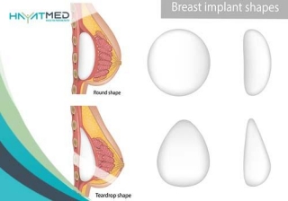 Navigating Your Journey: A Guide To Breast Augmentation Recovery