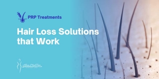 Hair Loss Solutions That Work: An In-Depth Look At PRP Treatments