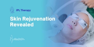 IPL Therapy: Your Ultimate Ally For Skin Rejuvenation Revealed