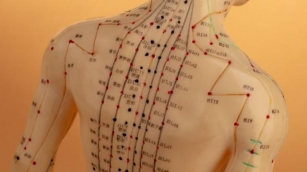 Acupuncture As A Path To Mental Wellness