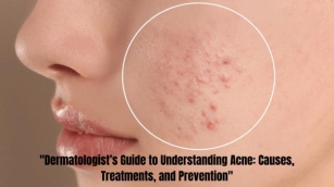 “The Ultimate Dermatologist’s Guide To Understanding Acne: Causes, Treatments, And Prevention”