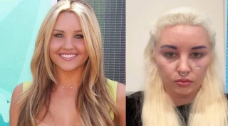 Amanda Bynes Speaks Up About Weight Gain Due To Mental Health Struggle