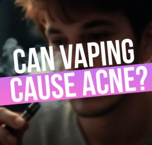 Can Vaping Cause Acne? Exploring The Link Between Vaping And Skin Health