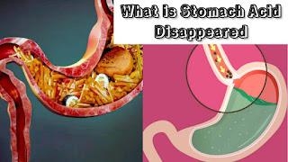 What Will Happen When Stomach Acid Disappeared, Human Body Digestion System.
