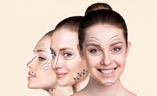 How Much Does A Mini Facelift Surgery Cost In India?