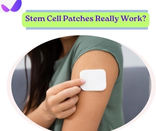 Can Stem Cell Patches Work? Know The Facts