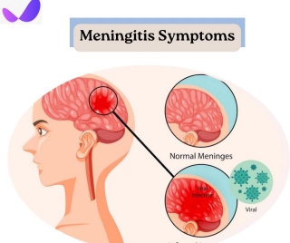 Meningitis Symptoms, Causes & How To Protect Yourself
